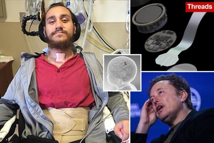 Elon Musk’s Neuralink encounters problem with first in-human brain implant