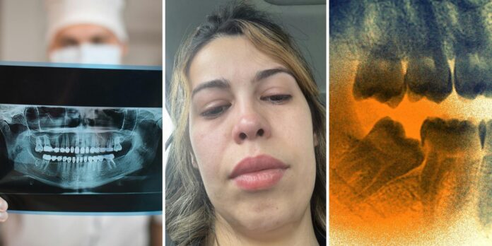 ‘Another reason i’m not gonna remove mine’: Woman goes in to get wisdom teeth removed. She leaves with a broken jaw