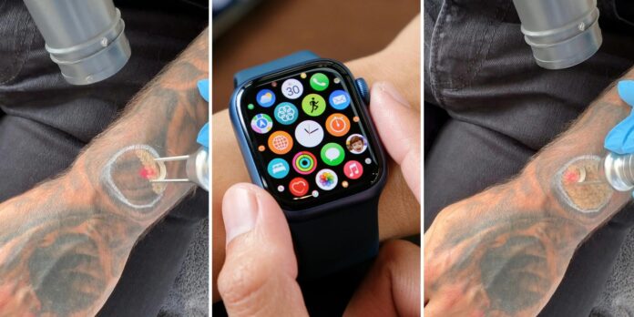 ‘My Apple Watch kept locking’: Man gets tattoo removed so Apple Watch can work properly. Can a tattoo really block an Apple Watch?