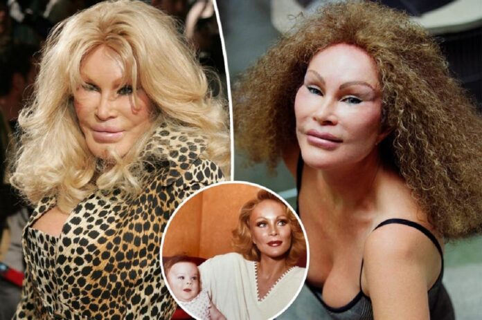 Jocelyn Wildenstein shares throwback photo, denies surgery rumours