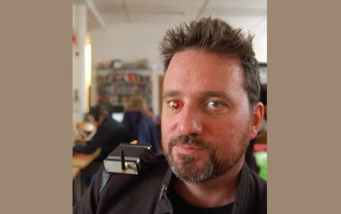 Filmmaker Rob Spence pioneers bionic camera eye after childhood accident