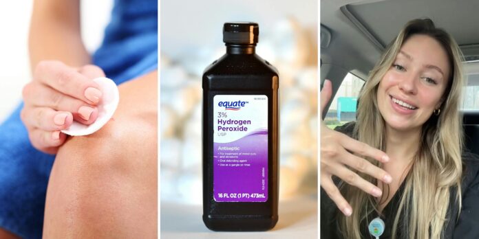 ‘Had a patient putting it in his EYE today’: Expert says you’re probably using hydrogen peroxide wrong