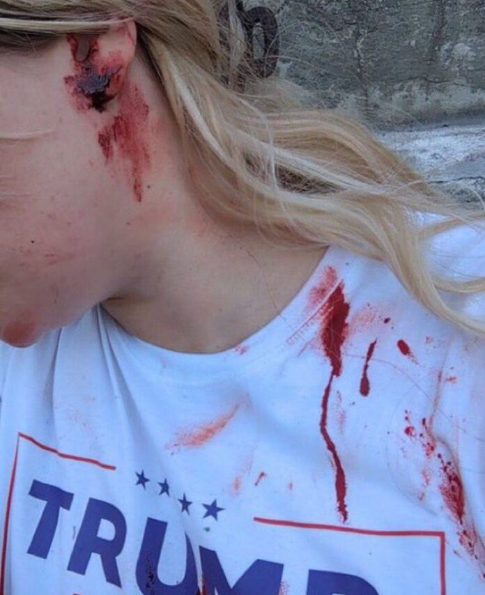 VIDEO: White girl bleeding from ear and knee after being beaten up by 2 African Americans for being a Trump supporter after being spotted wearing Trump tshirt at rally in Pennsylvania