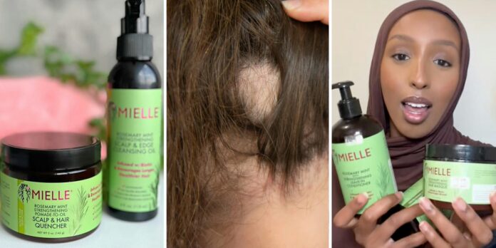 ‘It all makes sense now’: Woman warns against Mielle Organics after her hair ‘started to fall out’